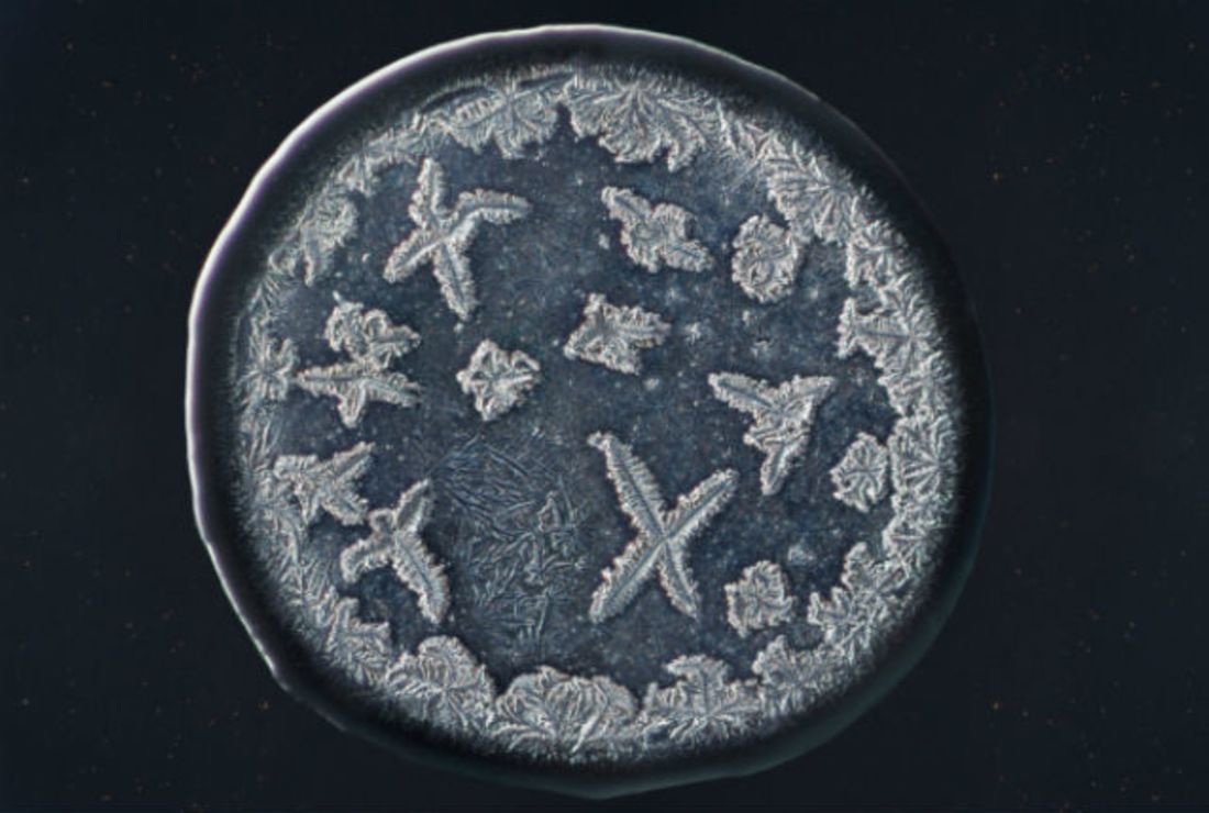 Структура слезы под микроскопом. Фотограф морис миккерс. Зубная бляшка под микроскопом. Разные слезы под микроскопом. Капля слезы под микроскопом.