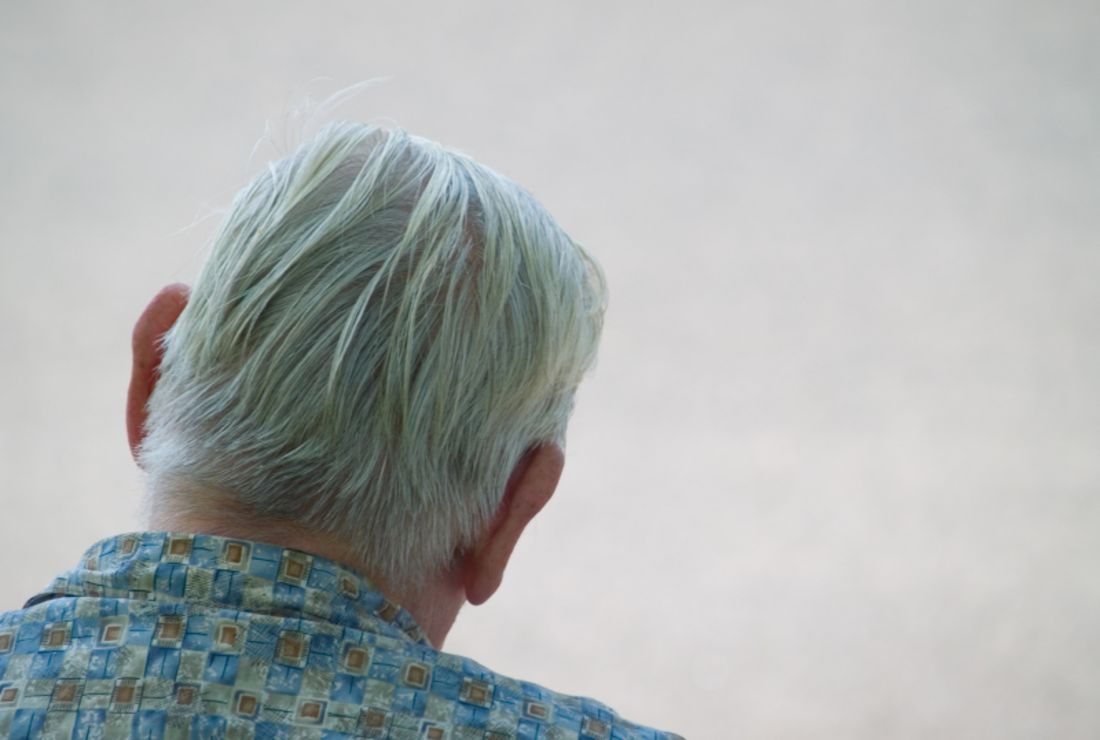 10 Head Scratching Facts About Gray Hair Mental Floss