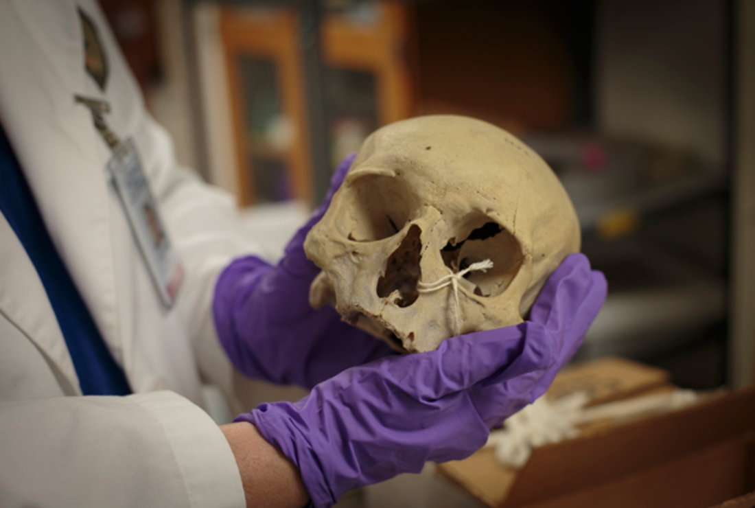 11 Things You Won T See On Display At The Mutter Museum Mental Floss