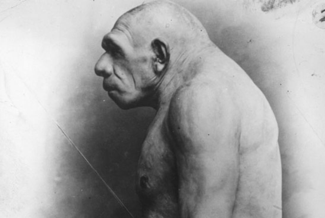 Mmmm Brains Everything You Wanted To Know About Cannibalism But Were Afraid To Ask Mental Floss Endocannibalism — + noun etymology: about cannibalism but were afraid