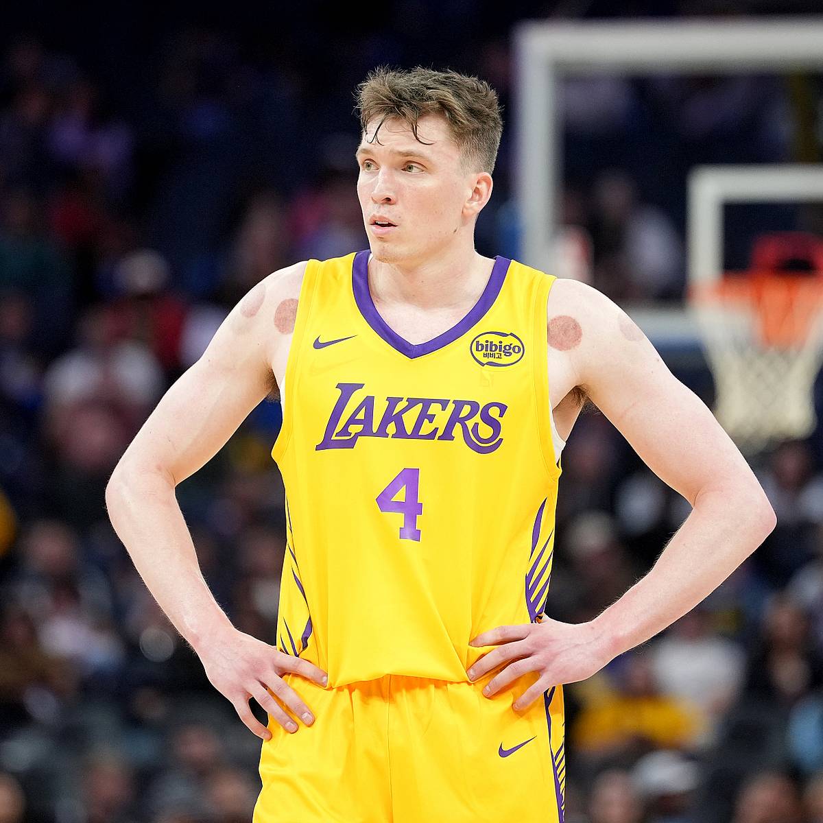 Dalton Knecht ruining Lakers dreams with nightmare summer league