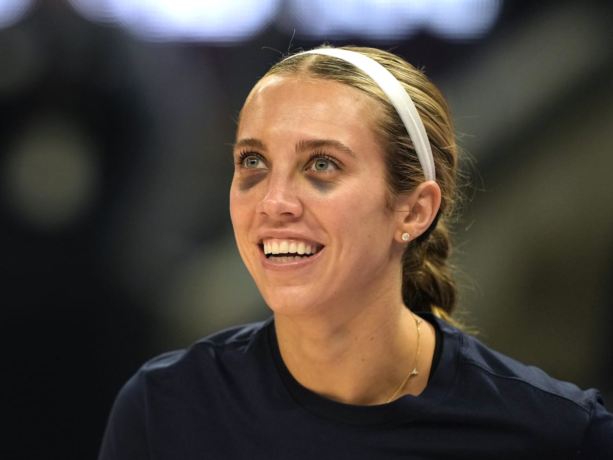 Lexie Hull Shares Indiana Fever Squad Black Eye Surprise