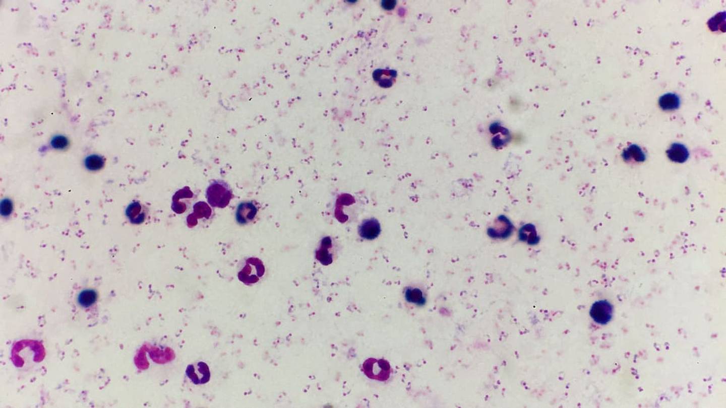 The Most Influential Parasite in History