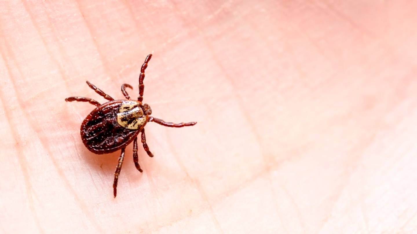 How to Remove a Tick Safely and Effectively