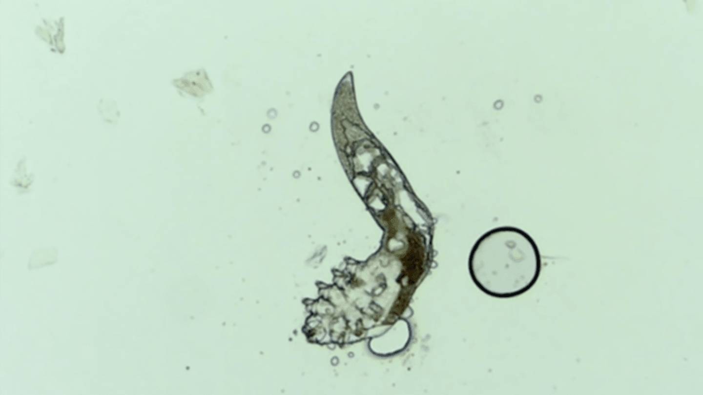 There are Poop-Filled Mites On Your Face Right Now
