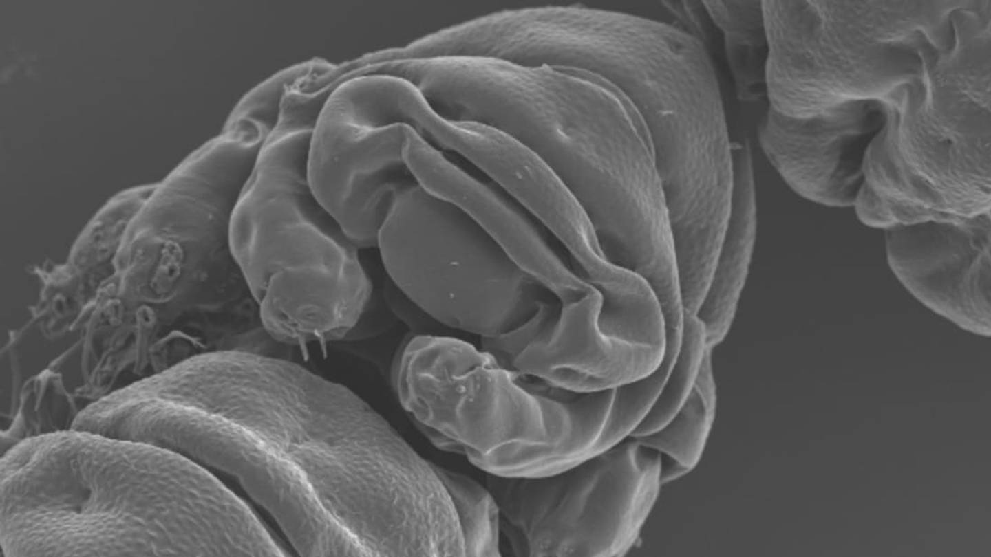 Water Bearsâ DNA Makes Them Practically Indestructible