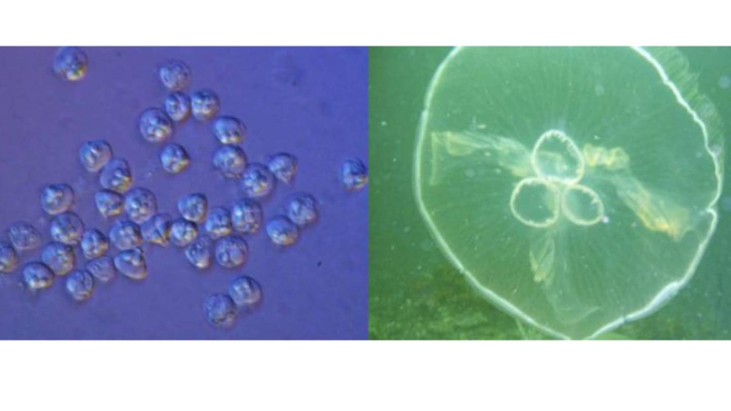 Microscopic Parasite Revealed to Be Teeny, Tiny Jellyfish