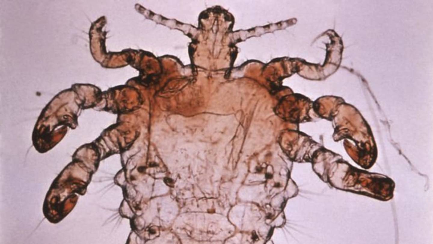 Are Pubic Lice Really Going Extinct?