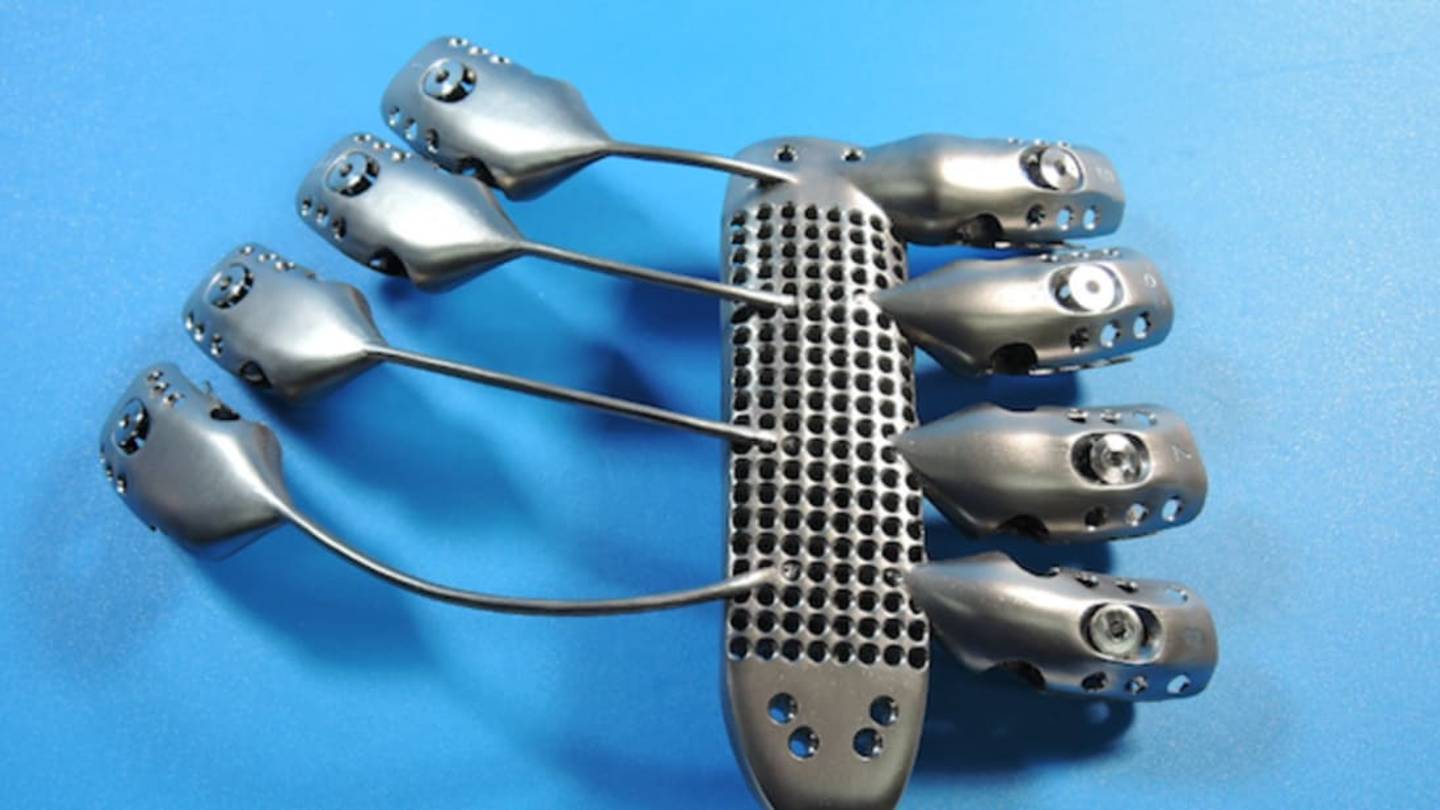 Real-Life Bionic Man Receives 3D-Printed Ribs and Sternum