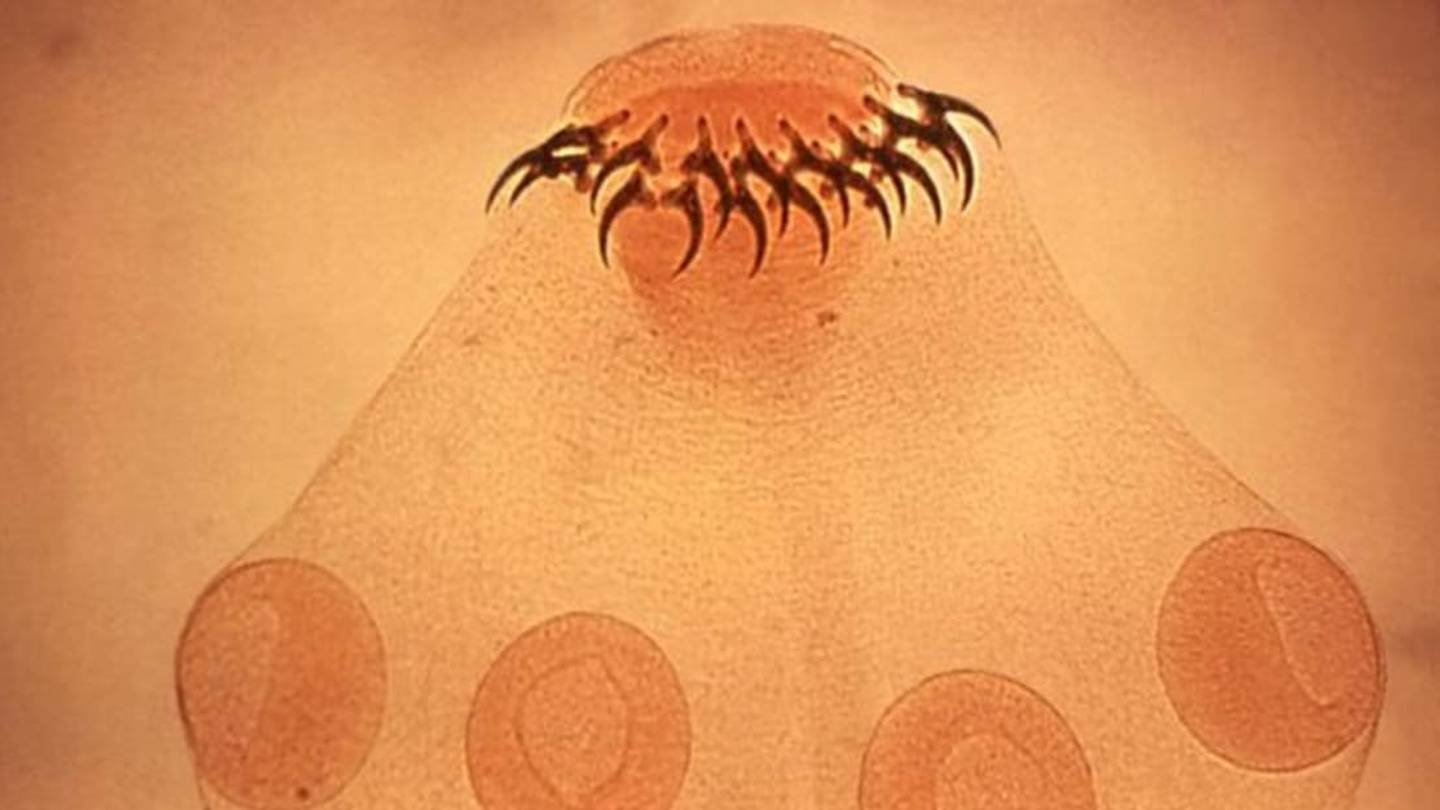 14 Surprising Truths About Tapeworms