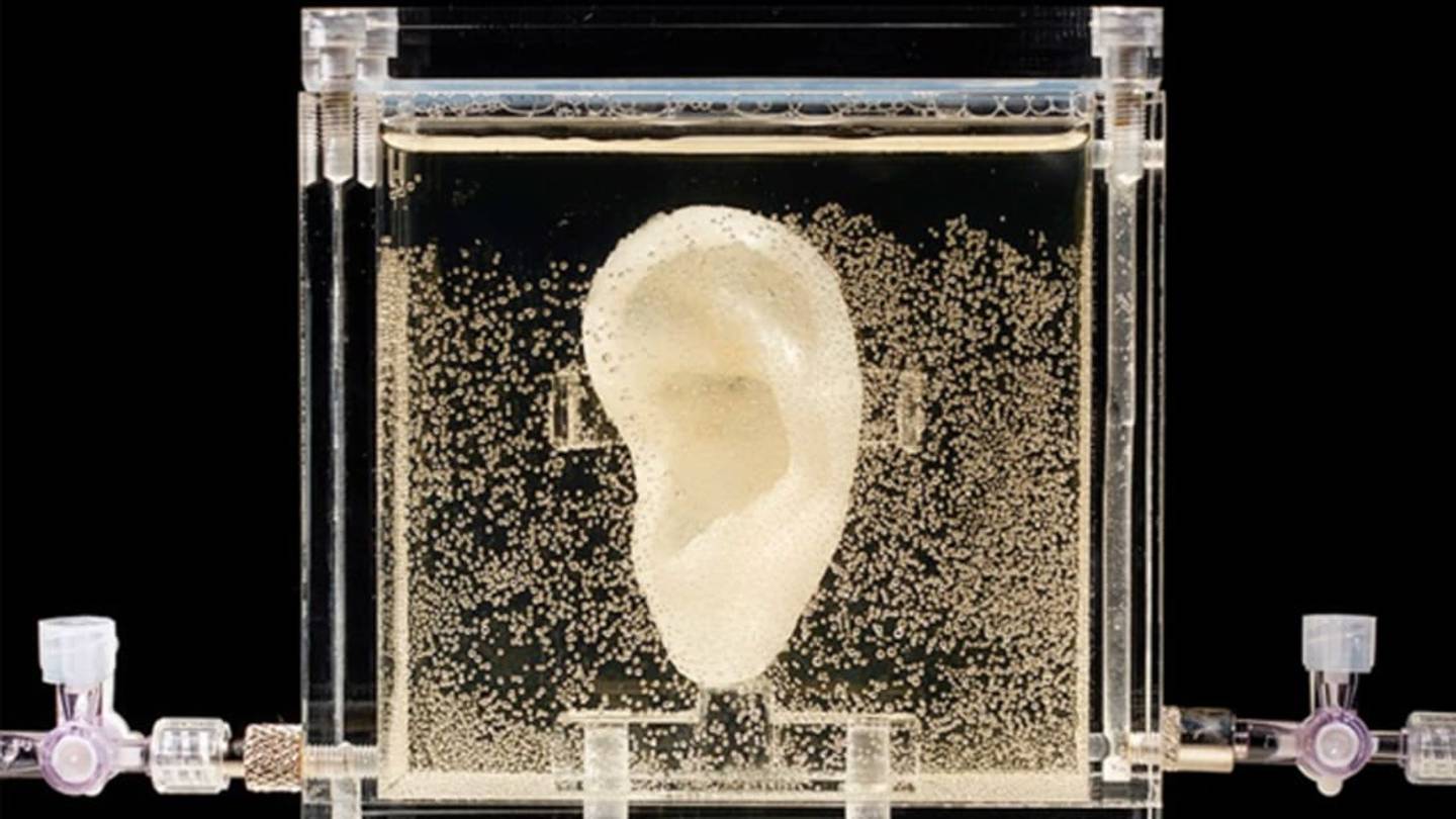 Bioengineered Replica of Vincent van Gogh's Ear Comes to New York