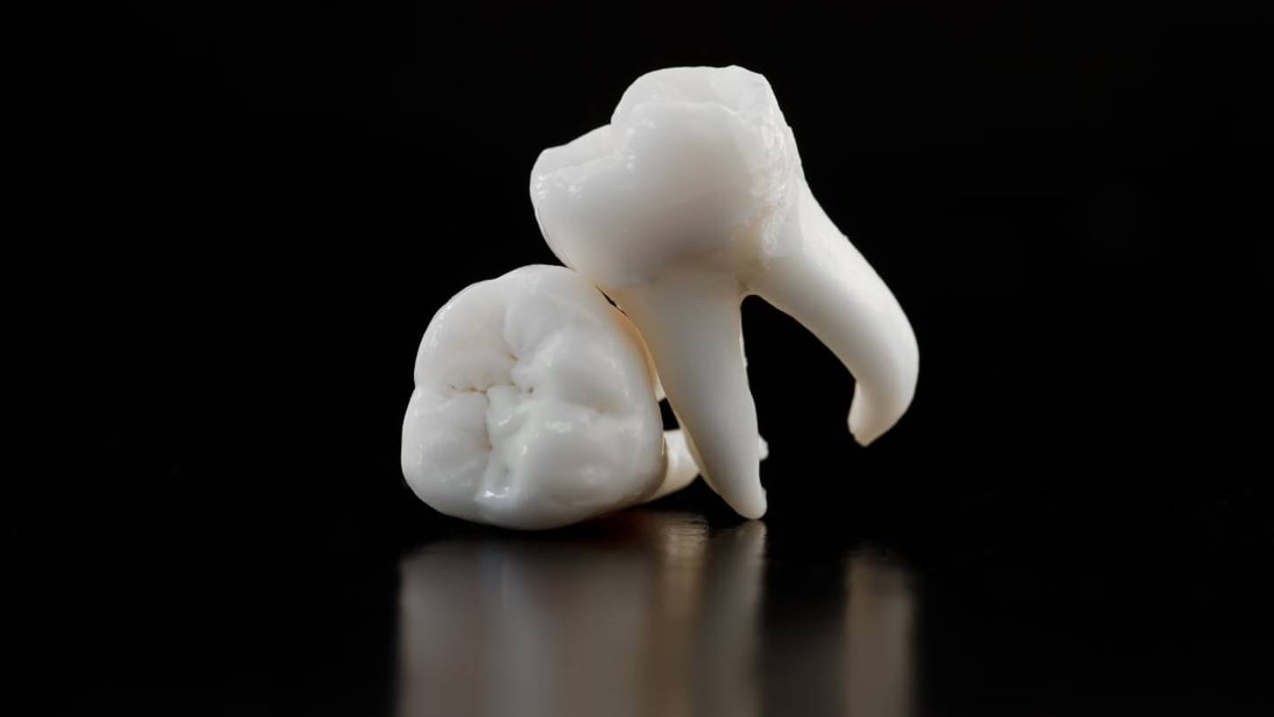 Teeth astrology in hindi