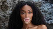 Winnie Harlow poses in front of natural rock formations.