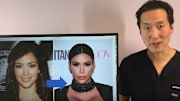 Anthony Youn, MD talks plastic surgery Kim Kardashian has likely gotten.