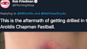 Getting beaned by an Aroldis Chapman fastball looks ridiculously painful. 
