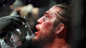 TORONTO, ON - DECEMBER 8: Brian Ortega of the United States is tended to by his cut man during a featherweight bout against Max Holloway of the United States during the UFC 231 event at Scotiabank Arena on December 8, 2018 in Toronto, Canada. (Photo by Vaughn Ridley/Getty Images)