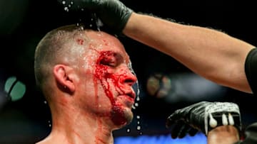 NEW YORK, NEW YORK - NOVEMBER 02: Nate Diaz of the United States has blood washed off his face during the Welterweight "BMF" championship bout against Jorge Masvidal of the United States in UFC 244 at Madison Square Garden on November 02, 2019 in New York City. (Photo by Steven Ryan/Getty Images)