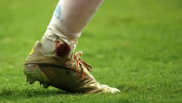 Argentina v Colombia: Semifinal - Copa America Brazil 2021 - La pierna de Messi, herida.