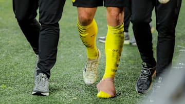 Beim BVB drohen einige Ausfälle