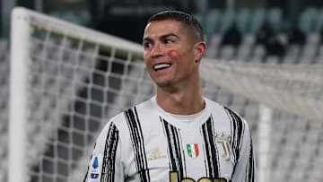 Juventus v Cagliari Calcio - Serie A