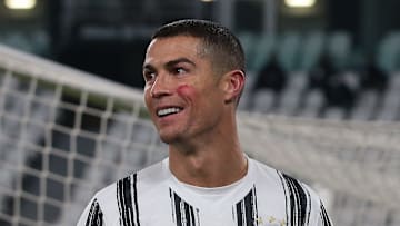 Juventus v Cagliari Calcio - Serie A