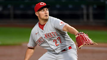 El temperamento de Bauer le juega en contra
