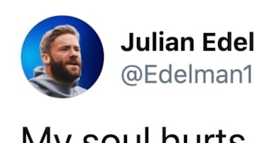 Julian Edelman is in shambles this Super Bowl Sunday