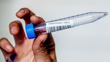 Auch in der Bundesliga kommt es derzeit häufiger zu positiven Corona-Tests bei Spielern