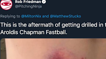 Getting beaned by an Aroldis Chapman fastball looks ridiculously painful. 
