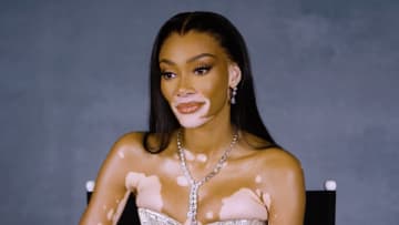 Winnie Harlow Prioritizes Skincare Through Her Busy, Glamorous Lifestyle