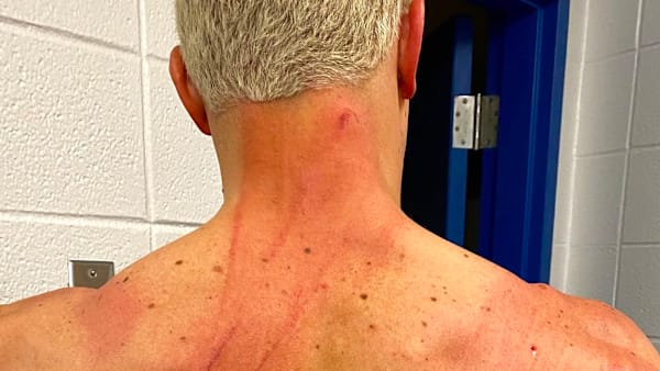 Cody Rhodes after taking 10 lashes Cody Rhodes after taking 10 lashes