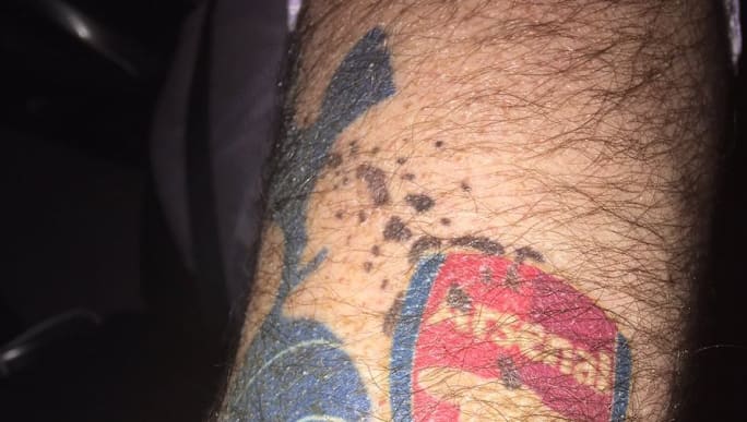 Photo Twitter Reacts As Spurs Fan Takes Arsenal Rivalry A Step Too Far With Unconventional Tattoo 90min