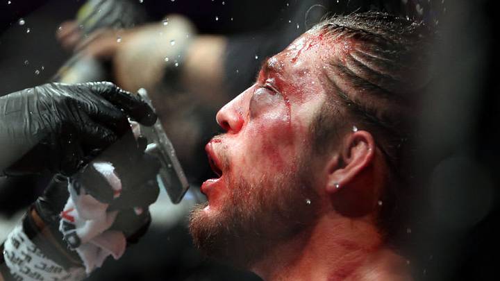 TORONTO, ON - DECEMBER 8: Brian Ortega of the United States is tended to by his cut man during a featherweight bout against Max Holloway of the United States during the UFC 231 event at Scotiabank Arena on December 8, 2018 in Toronto, Canada. (Photo by Vaughn Ridley/Getty Images)