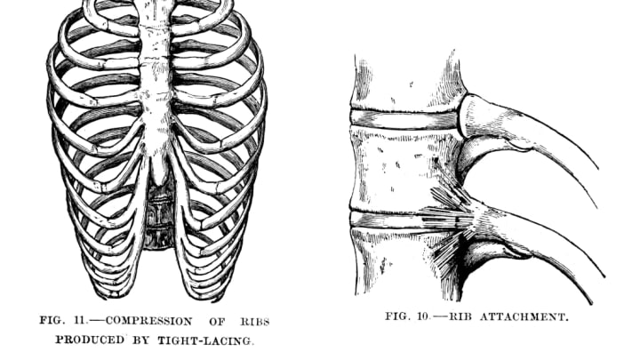 Do any other women struggle with have a huge rib cage that looks