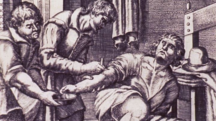 30 Strange Old-Timey Medical Treatments