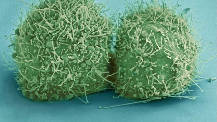 A scanning electron micrograph of just-divided HeLa cells