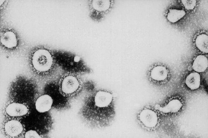CDC Says SARS Might Be A Form Of The Coronavirus