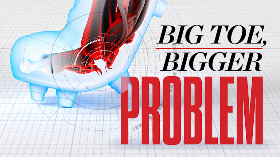 Illustration of the inside of a foot. Text says: Big toe, bigger problem