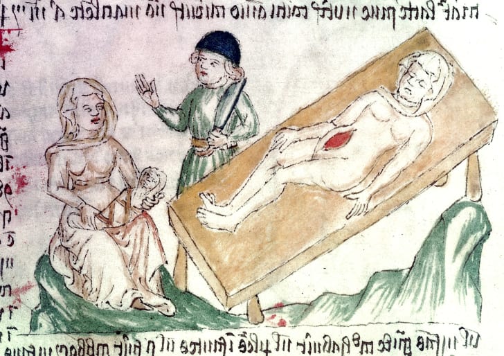 Just How Old Is C Section Birth Mental Floss