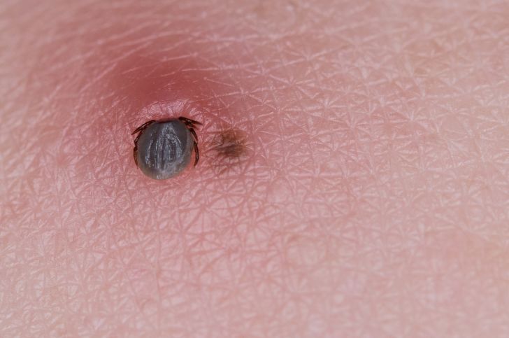 Tick bite next to a freckle.
