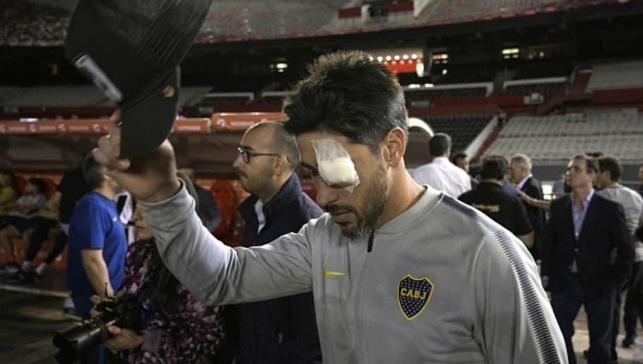 Capitão do Boca, Pérez fala em 'medo de morrer' com uma possível volta ao estádio do River 5bfc5957a133b673b4000002