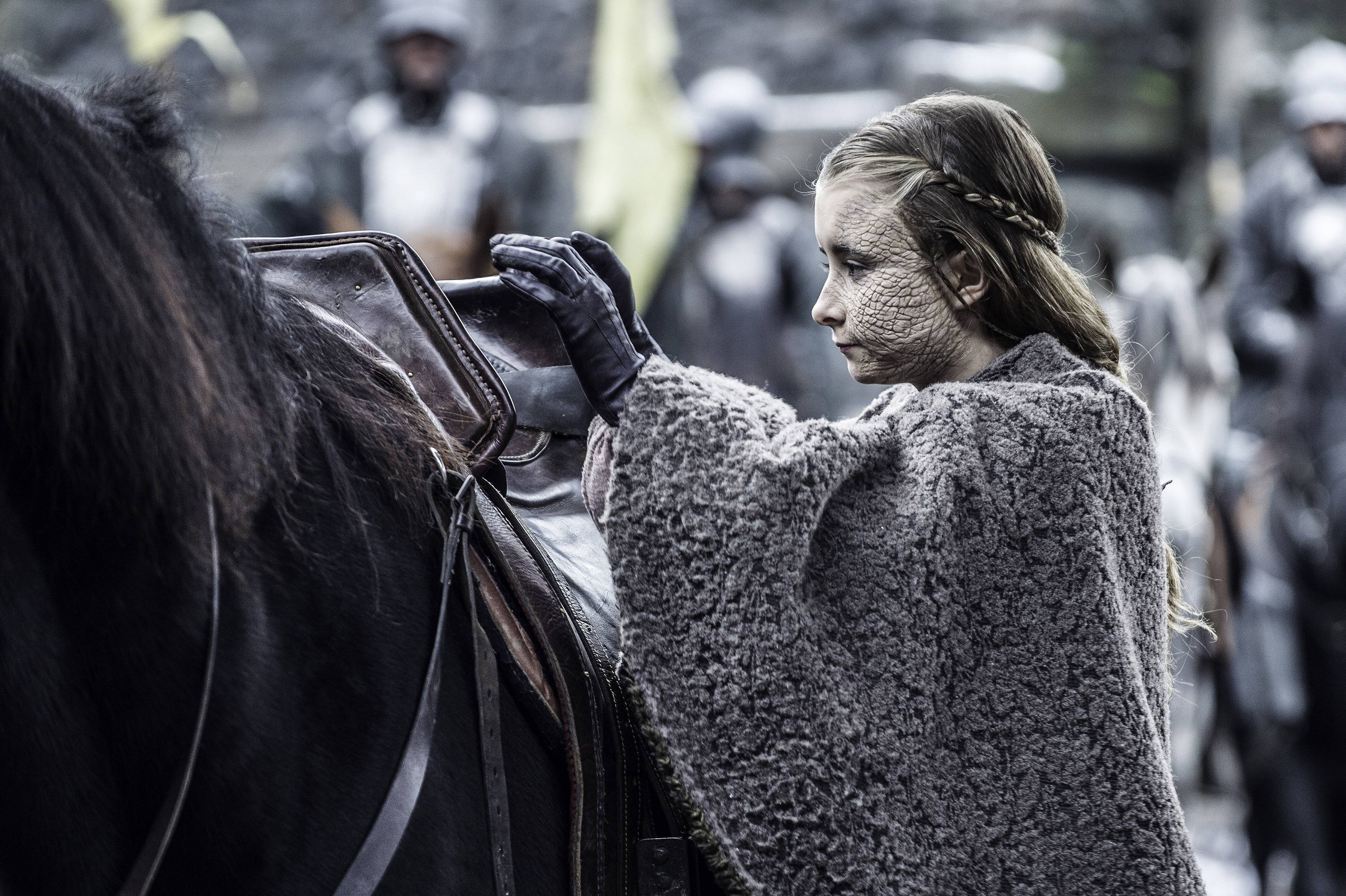 Kerry Ingram (Shireen Baratheon) in Game of Thrones season 5 Episode 5, "Kill the Boy"
