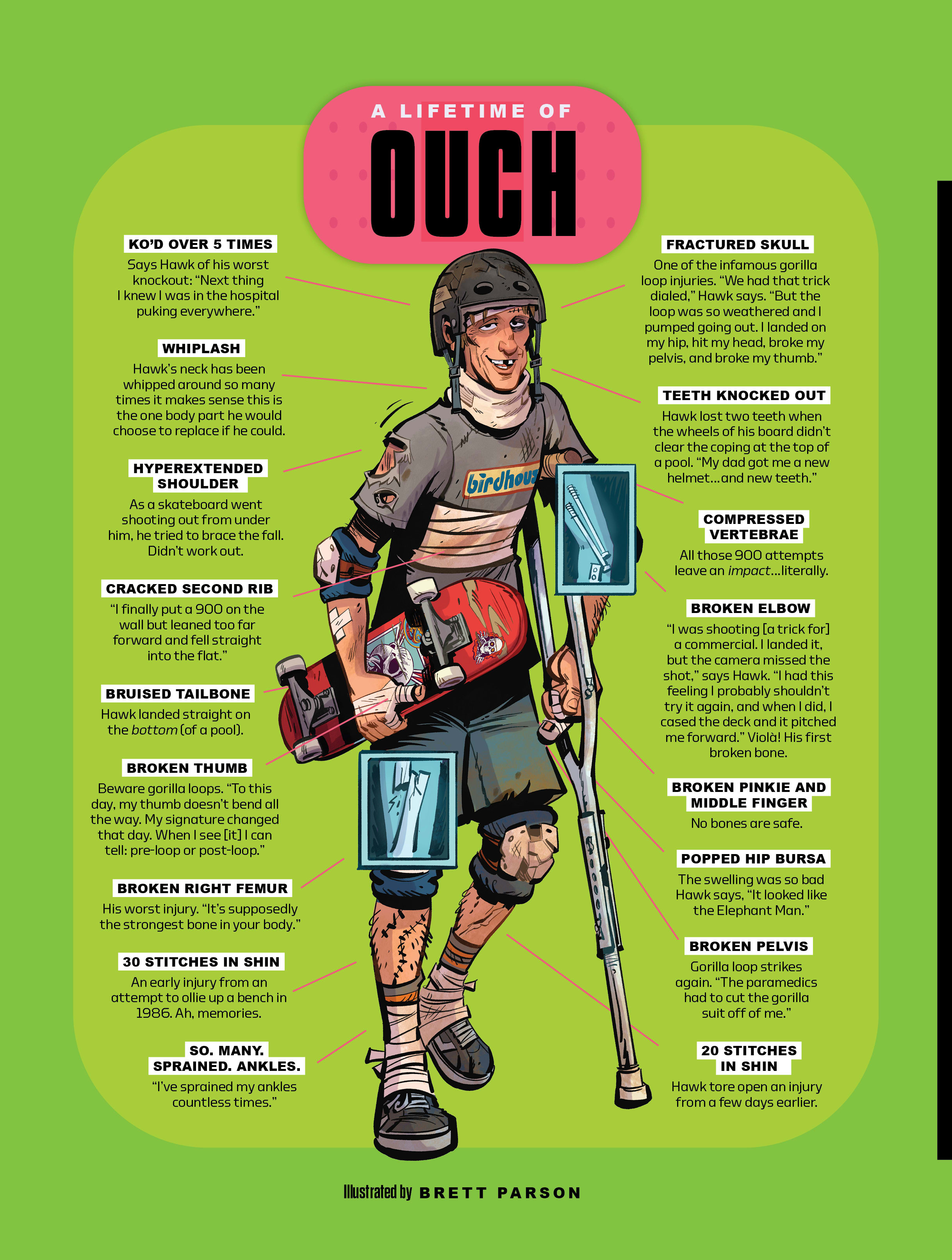 Tony Hawk injuries