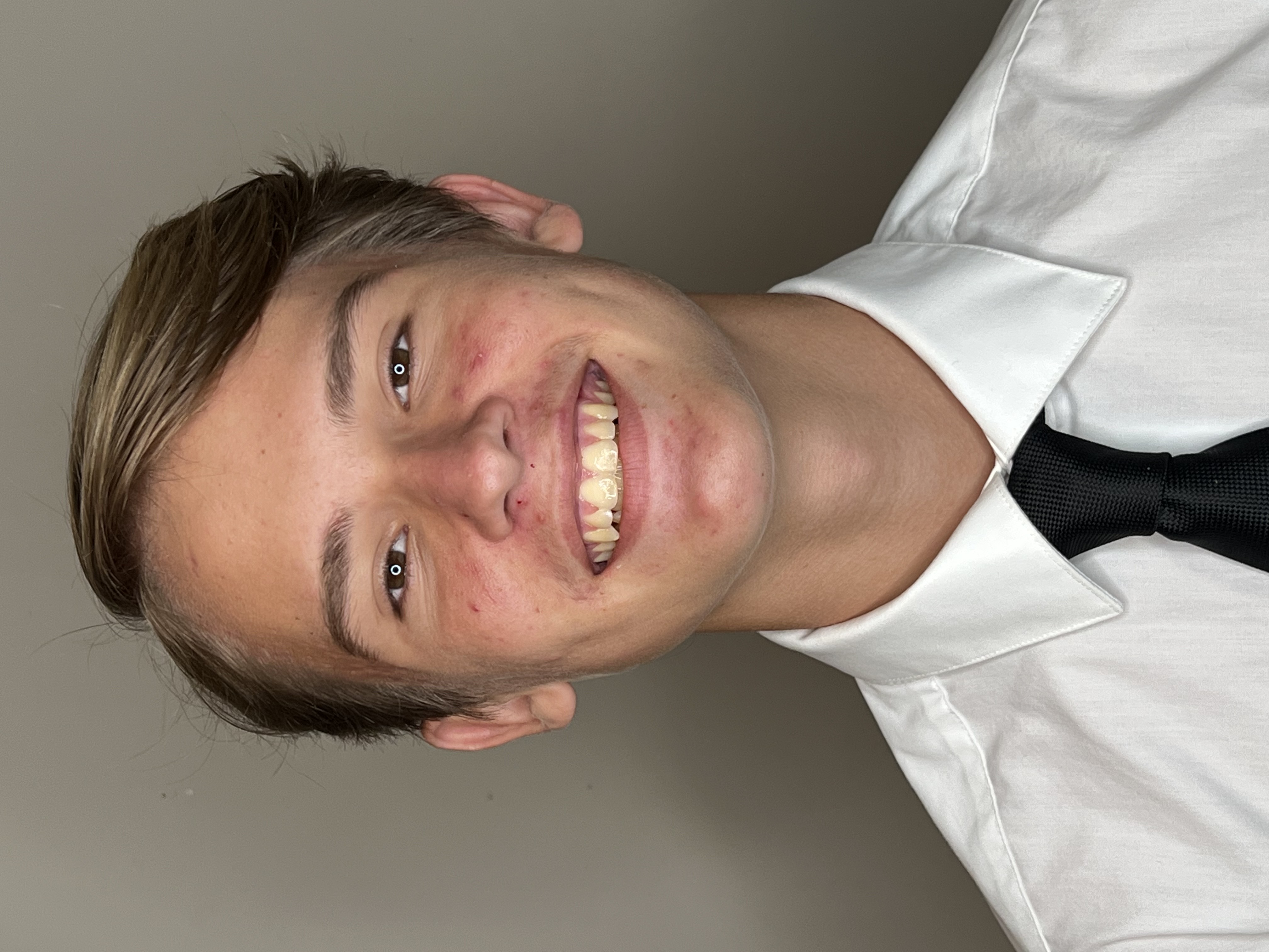 Hunter Simpson