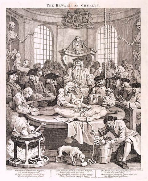 This dissection of a criminal in 1751 in a theater resembling those at the Royal College of Physicians and the the Barber Surgeons’ Hall.