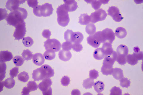 Plasmodium falciparum, which causes malaria in people.