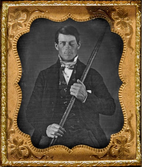 Phineas Gage with the tamping iron