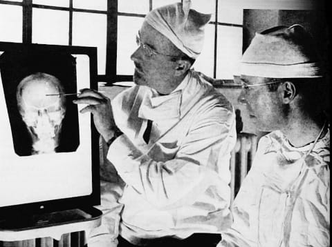 Freeman (left) and Watts study a patient's X-ray before performing psychosurgery.