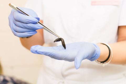 A doctor holds a medical leech with tweezers.