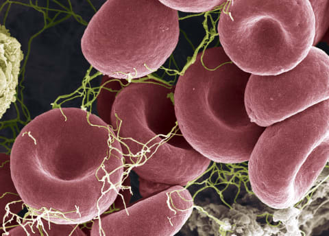 A scanning electron microscope image of red blood cells.